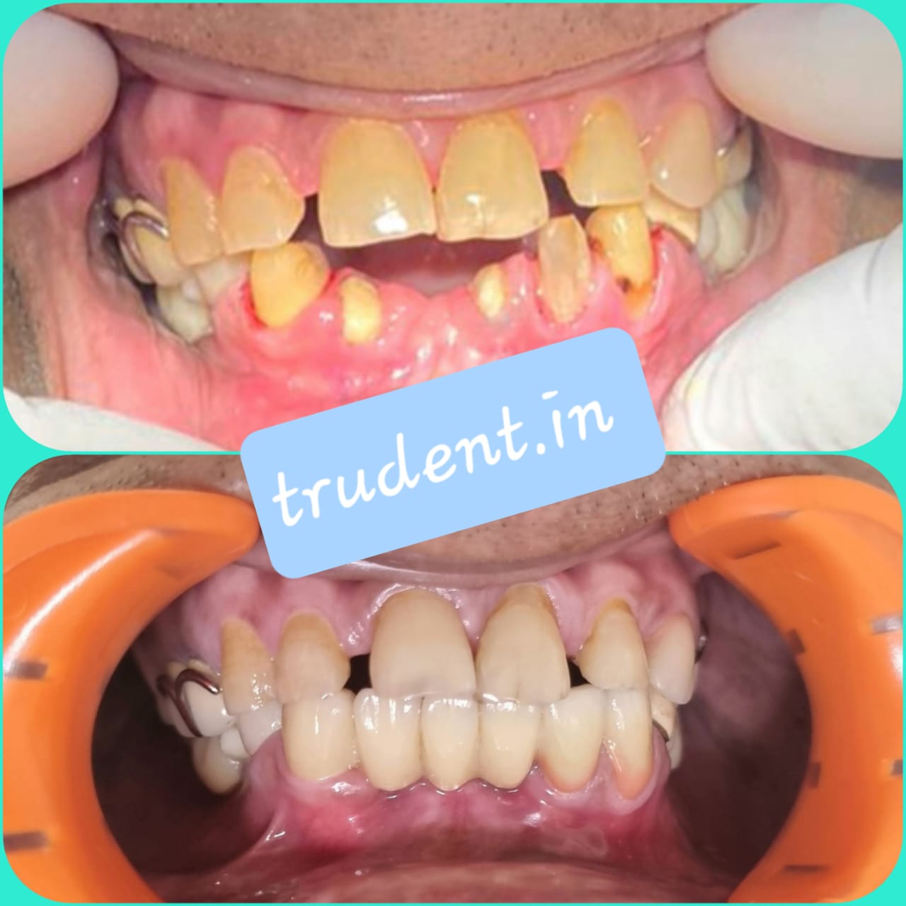 Trudent Dental Care Clinic